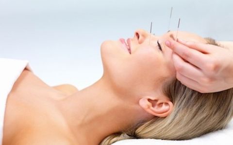 Image for Wellness holiday with acupuncture