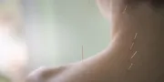 Acupuncture | L'Albereta Relais & Chateaux